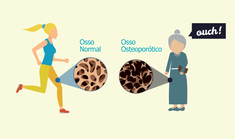 Campanha de Conscientização Global 2016 para o Dia Mundial da Osteoporose